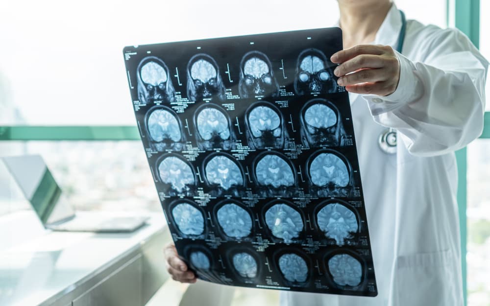 A doctor holds a brain scan, examining images for signs of traumatic brain injury.